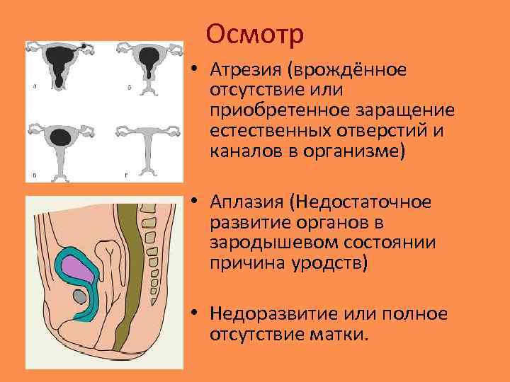 Синдром рокитанского кюстнера майера хаузера