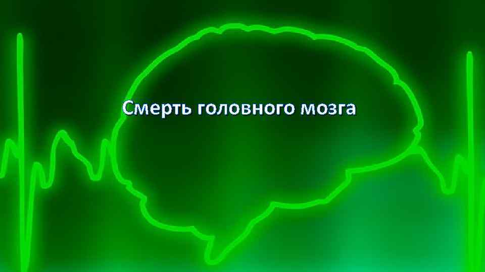 Смерть головного мозга 