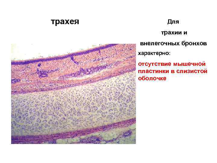 трахея Для трахии и внелегочных бронхов характерно: отсутствие мышечной пластинки в слизистой оболочке 