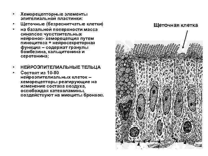 Эпителий слизистой оболочки. Эпителий воздухоносных путей гистология. Щеточные клетки воздухоносных путей функция. Щеточные клетки гистология. Безреснитчатые клетки.