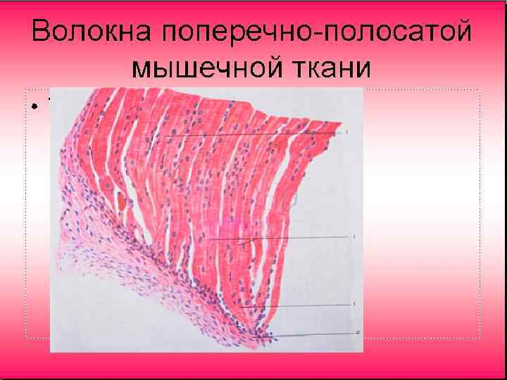 Поперечно полосатая мышечная ткань строение