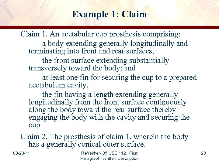 Example 1: Claim 1. An acetabular cup prosthesis comprising: a body extending generally longitudinally