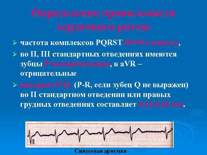 Определение правильности сердечного ритма частота комплексов PQRST 60 -90 в минуту, Ø во II,