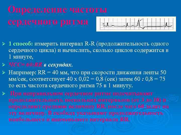 Определение частоты сердечного ритма 1 способ: измерить интервал R-R (продолжительность одного сердечного цикла) и