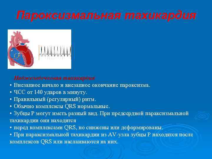 Пароксизмальная тахикардия Наджеледочковая тахикардия • Внезапное начало и внезапное окончание пароксизма. • ЧСС от