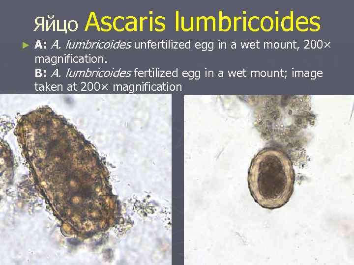 Яйцо Аscaris lumbricoides ► A: A. lumbricoides unfertilized egg in a wet mount, 200×