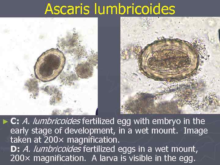 Аscaris lumbricoides ► C: A. lumbricoides fertilized egg with embryo in the early stage