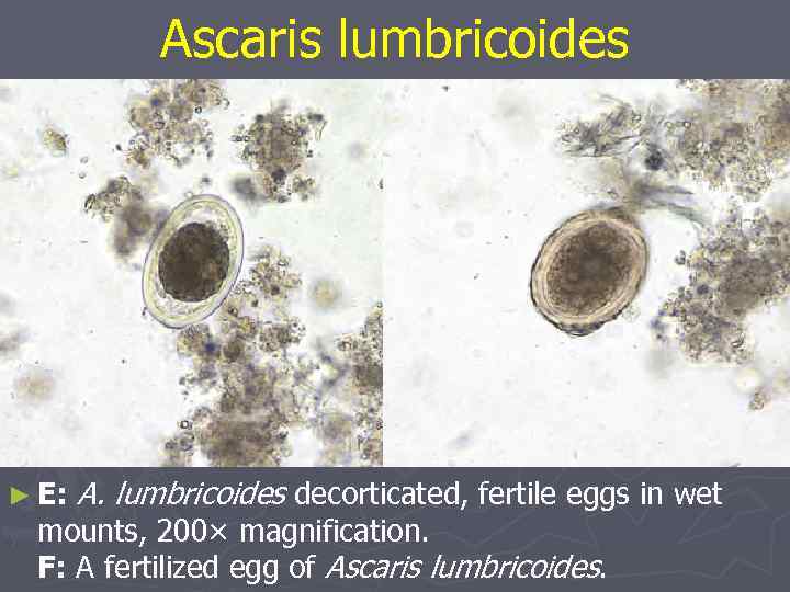 Аscaris lumbricoides ► E: A. lumbricoides decorticated, fertile eggs in wet mounts, 200× magnification.