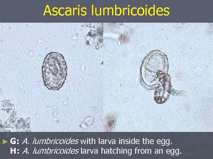 Аscaris lumbricoides ► G: A. lumbricoides with larva inside the egg. H: A. lumbricoides