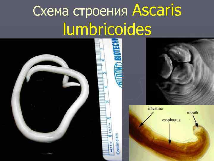 Схема строения Аscaris lumbricoides 