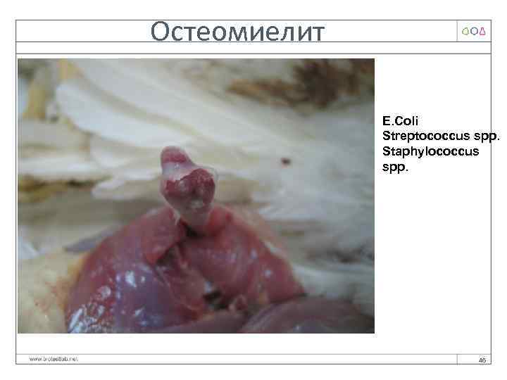 Остеомиелит E. Coli Streptococcus spp. Staphylococcus spp. 46 