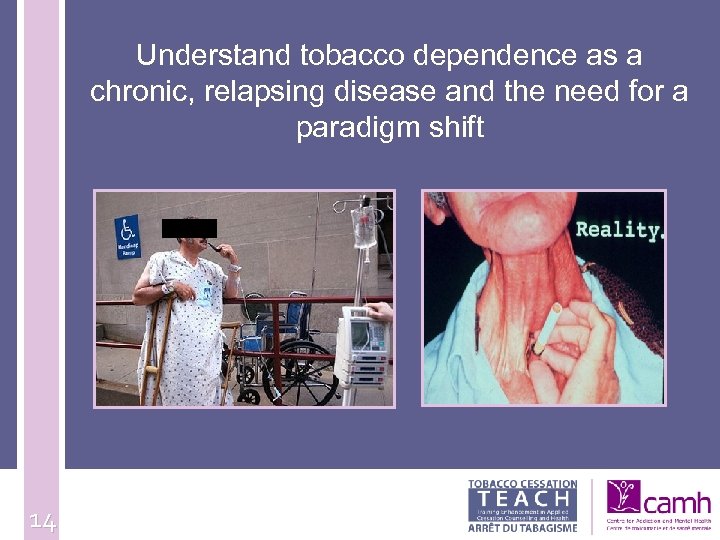 Understand tobacco dependence as a chronic, relapsing disease and the need for a paradigm