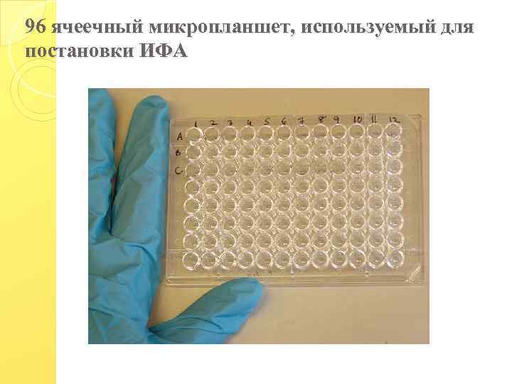 96 ячеечный микропланшет, используемый для постановки ИФА 