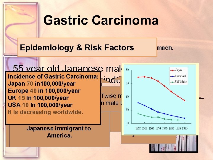 Gastric Carcinoma Epidemiology &Malignant lesion of the stomach. Risk Factors DEFINITION 55 year old