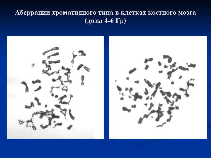 Аберрации хроматидного типа в клетках костного мозга (дозы 4 -6 Гр) 