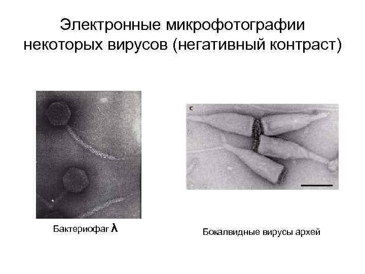 Электронные микрофотографии некоторых вирусов (негативный контраст) Бактериофаг λ Бокалвидные вирусы архей 