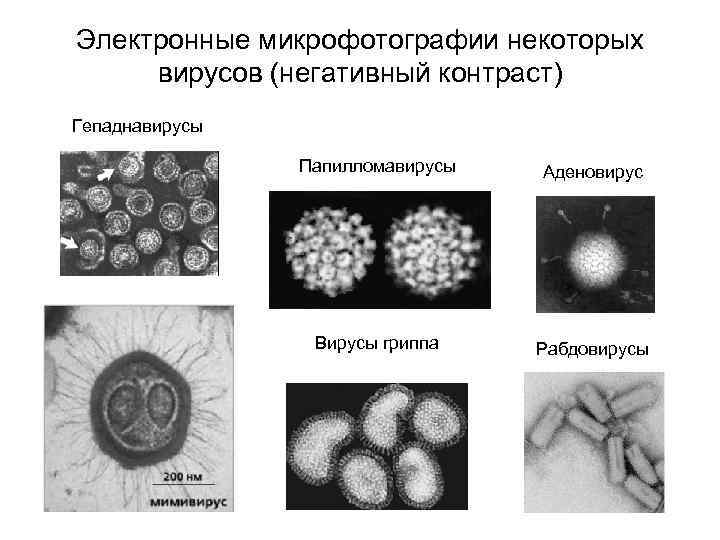 Электронные микрофотографии некоторых вирусов (негативный контраст) Гепаднавирусы Папилломавирусы Аденовирус Вирусы гриппа Рабдовирусы 