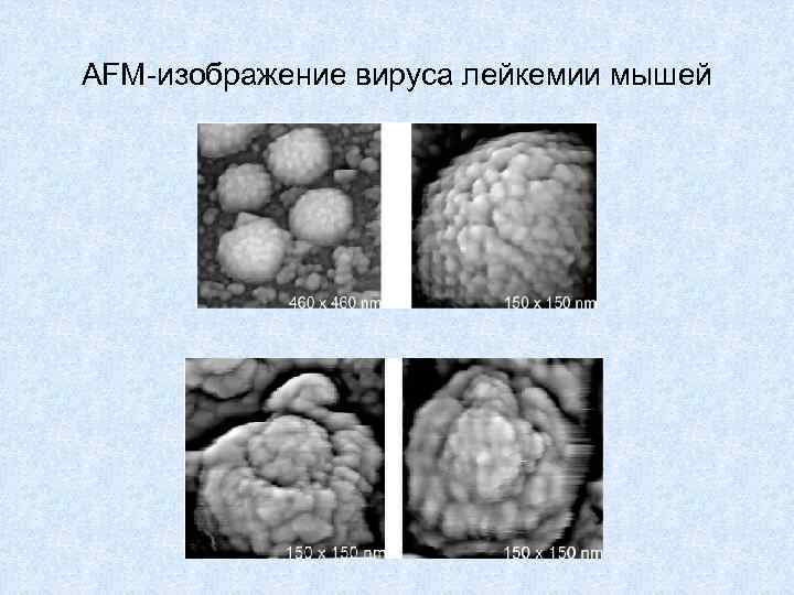 AFM-изображение вируса лейкемии мышей 