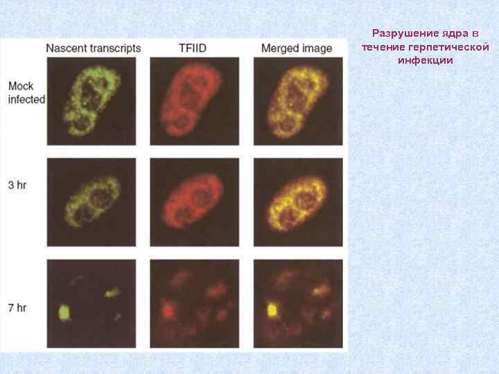 Разрушение ядра в течение герпетической инфекции 