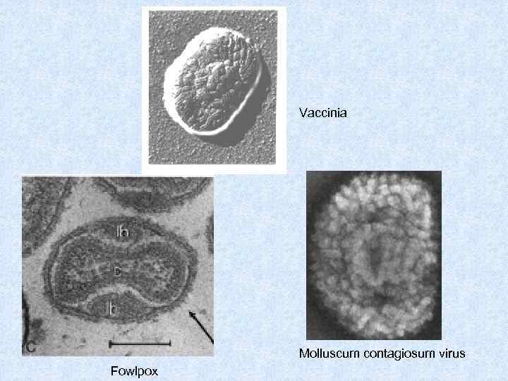 Vaccinia Molluscum contagiosum virus Fowlpox 