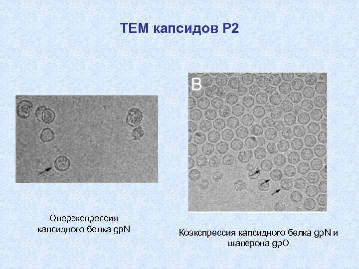 ТЕМ капсидов Р 2 Оверэкспрессия капсидного белка gp. N Коэкспрессия капсидного белка gp. N