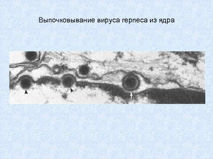 Выпочковывание вируса герпеса из ядра 