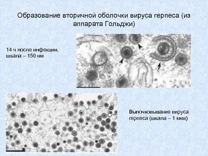 Образование вторичной оболочки вируса герпеса (из аппарата Гольджи) 14 ч после инфекции, шкала –