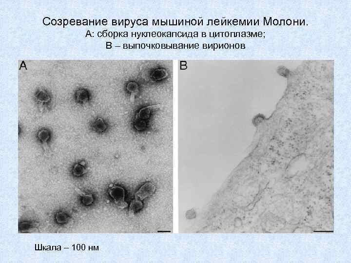 Созревание вируса мышиной лейкемии Молони. А: сборка нуклеокапсида в цитоплазме; В – выпочковывание вирионов