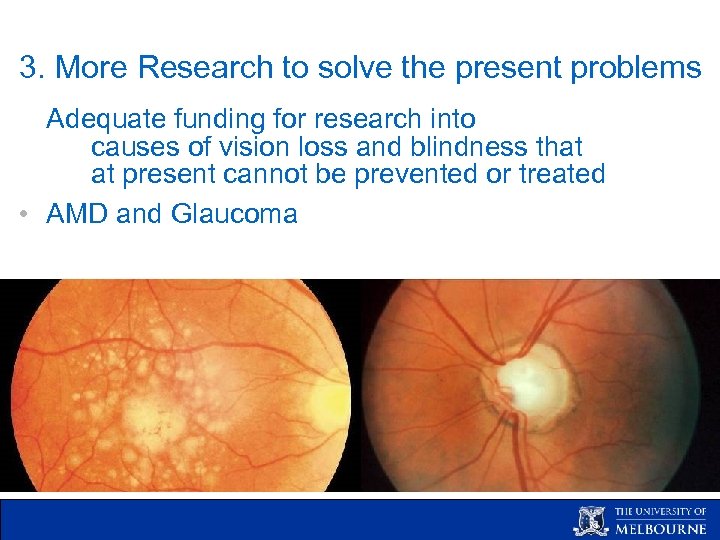 3. More Research to solve the present problems Adequate funding for research into causes