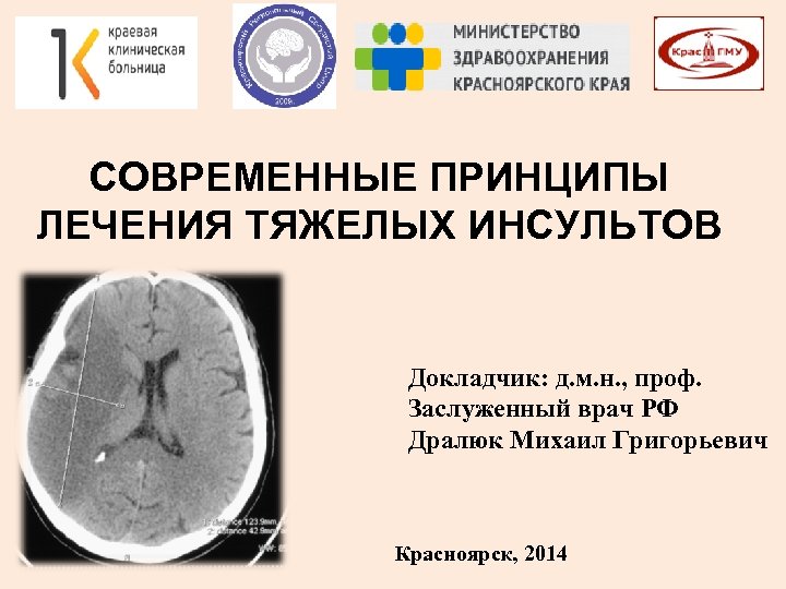 СОВРЕМЕННЫЕ ПРИНЦИПЫ ЛЕЧЕНИЯ ТЯЖЕЛЫХ ИНСУЛЬТОВ Докладчик: д. м. н. , проф. Заслуженный врач РФ