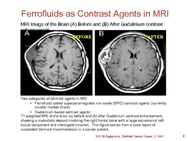 Ferrofluids as Contrast Agents in MRI Image of the Brain (A) Before and (B)