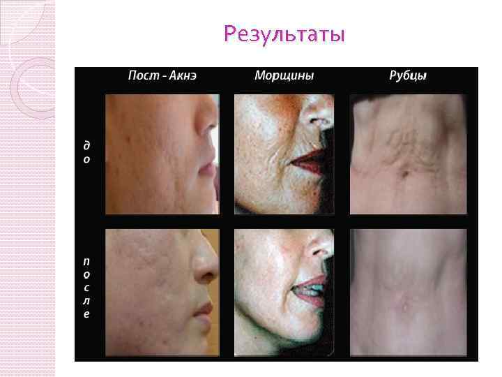 Результаты 