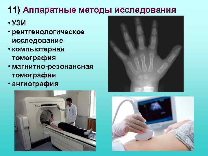 11) Аппаратные методы исследования • УЗИ • рентгенологическое исследование • компьютерная томография • магнитно-резонансная