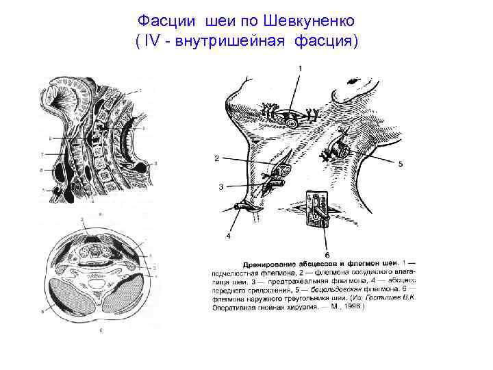 Фасции шеи по Шевкуненко ( IV - внутришейная фасция) 