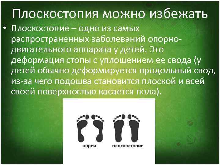 Плоскостопия можно избежать • Плоскостопие – одно из самых распространенных заболеваний опорнодвигательного аппарата у