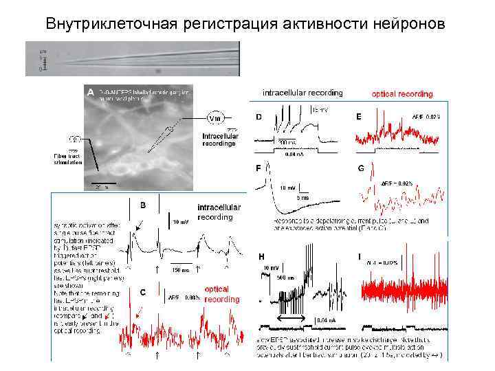 Внутриклеточная регистрация активности нейронов 