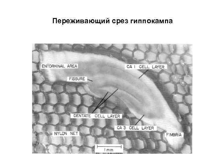 Переживающий срез гиппокампа 