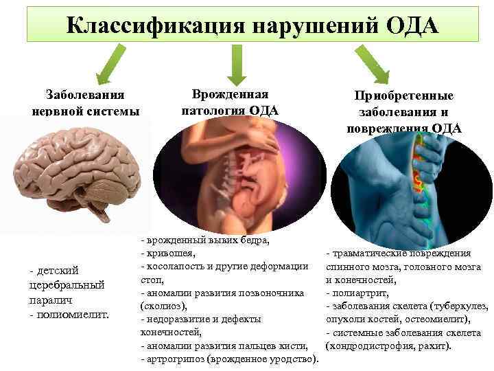 Наследственное заболевание мозга