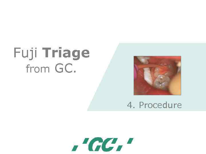 Fuji Triage from GC. 4. Procedure 