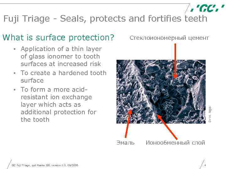 Fuji Triage - Seals, protects and fortifies teeth What is surface protection? Стеклоиономерный цемент