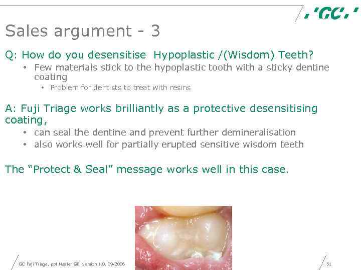 Sales argument - 3 Q: How do you desensitise Hypoplastic /(Wisdom) Teeth? • Few