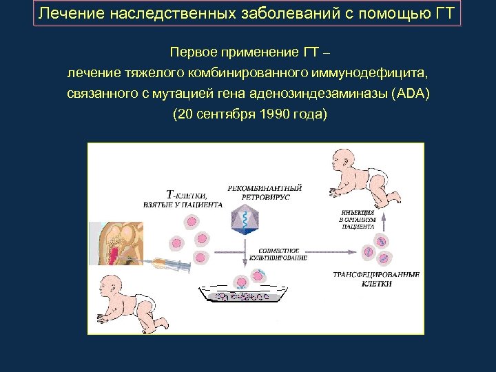 Лечение наследственных заболеваний с помощью ГТ Первое применение ГТ – лечение тяжелого комбинированного иммунодефицита,