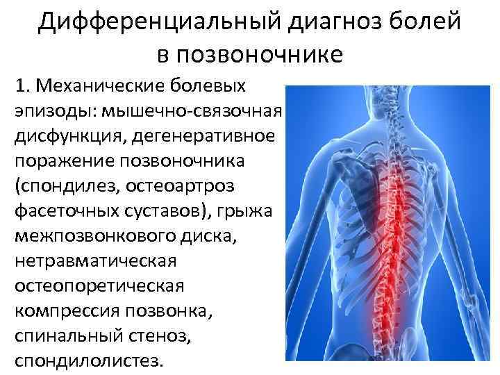 Дифференциальный диагноз болей в позвоночнике 1. Механические болевых эпизоды: мышечно-связочная дисфункция, дегенеративное поражение позвоночника