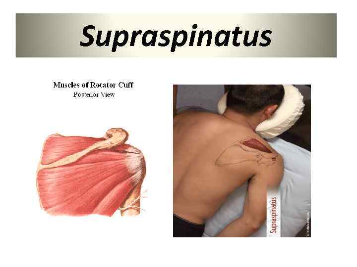 Supraspinatus 