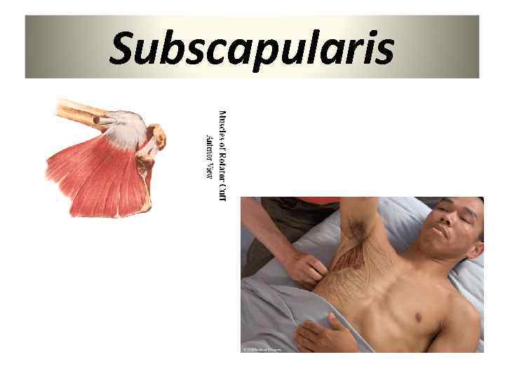 Subscapularis 