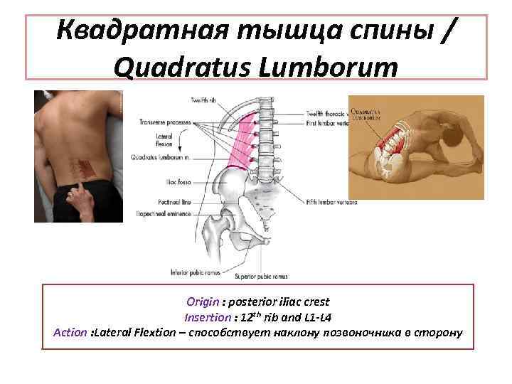 Квадратная тышца спины / Quadratus Lumborum Origin : posterior iliac crest Insertion : 12