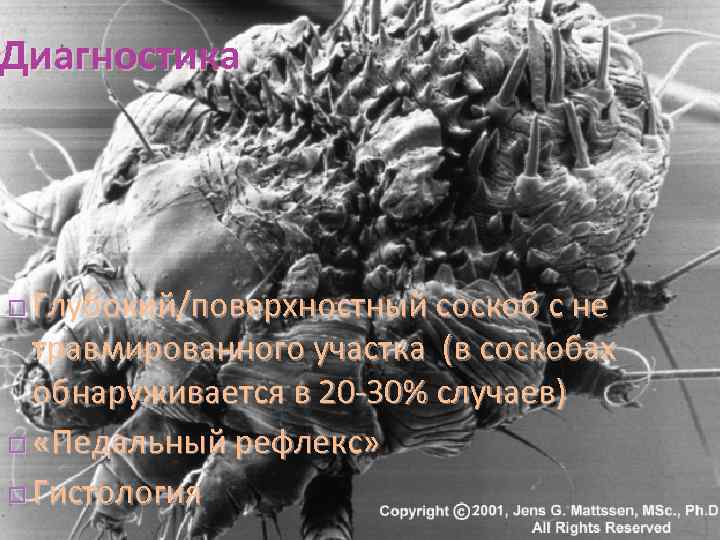 Диагностика Глубокий/поверхностный соскоб с не травмированного участка (в соскобах обнаруживается в 20 -30% случаев)