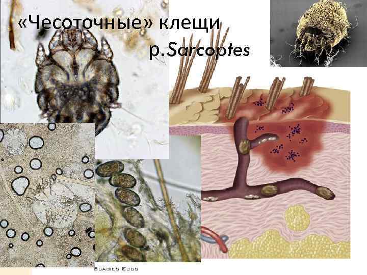  «Чесоточные» клещи р. Sarcoptes 