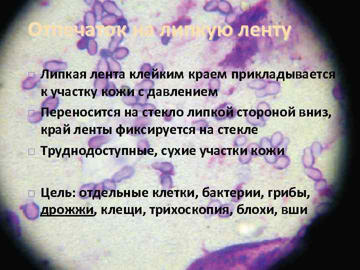 Отпечаток на липкую ленту Липкая лента клейким краем прикладывается к участку кожи с давлением