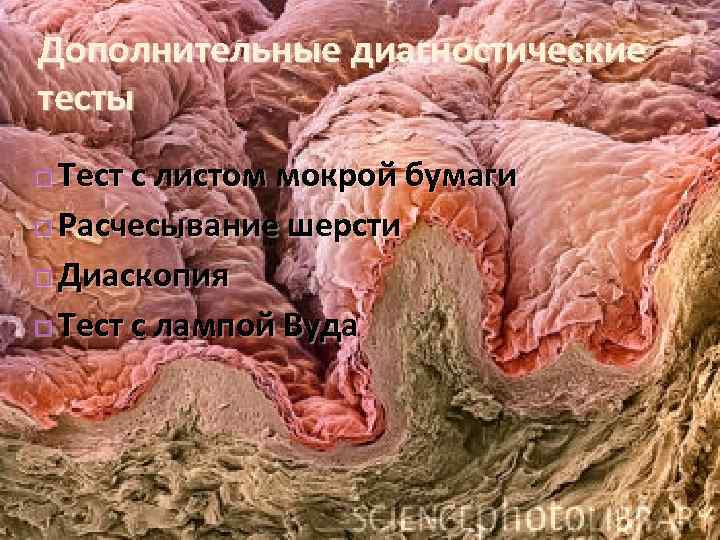 Дополнительные диагностические тесты Тест с листом мокрой бумаги Расчесывание шерсти Диаскопия Тест с лампой